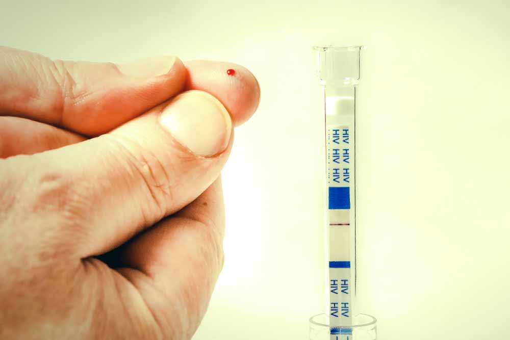HIV Finger Stick Blood Test