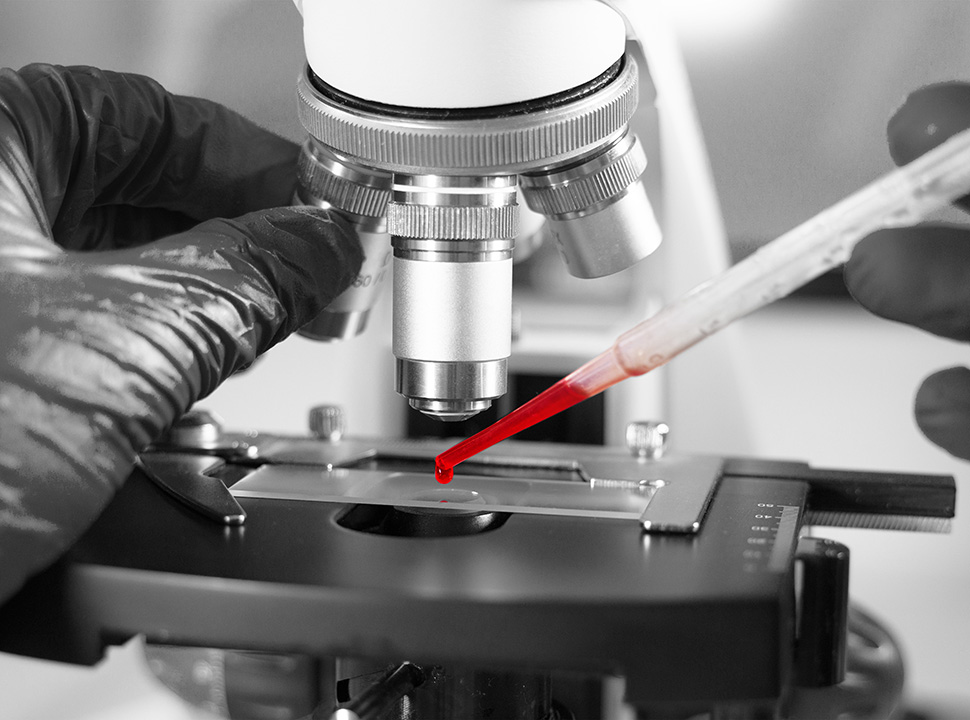 Blood drop being put under microscope