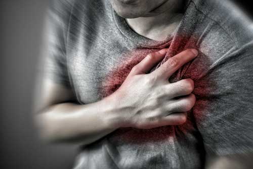 Heart attack image