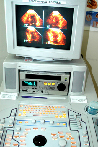 RGA Underwriting University II - EKGs and Echos RGA Underwriting University II - EKGs and Echos