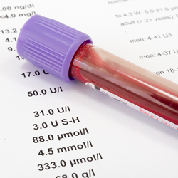 Blood vial rests on paper test results