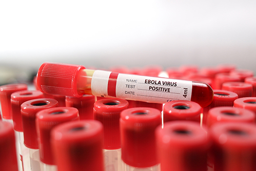 Ebola virus test