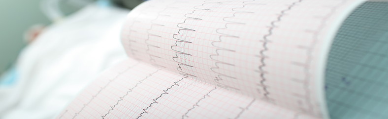 Ekg long Ekg long