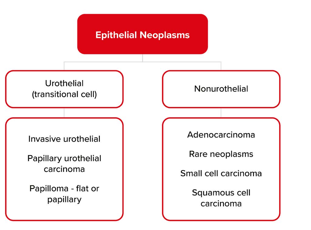 Epithelial Neoplasms