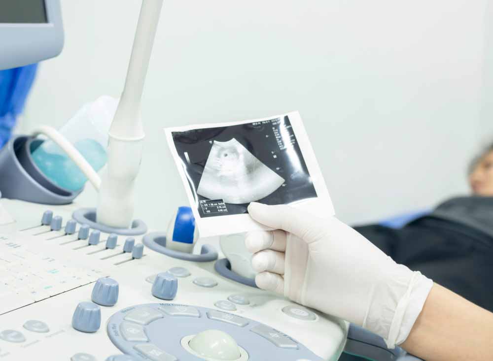 Fetal ultrasound