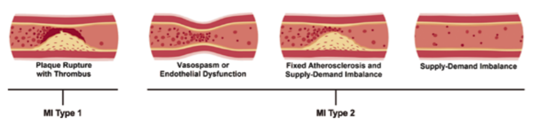 Figure 2, Myocardial Figure 2, Myocardial