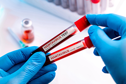 Hantavirus test