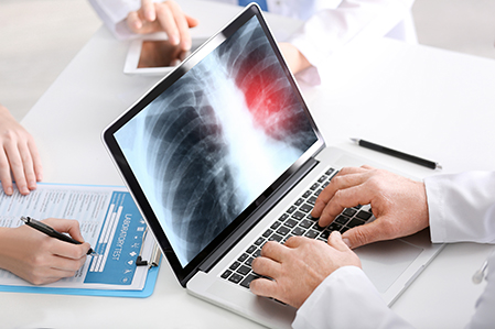 Lung cancer screening