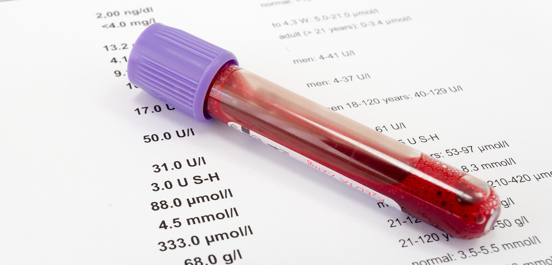A blood vial rests atop medical lab results