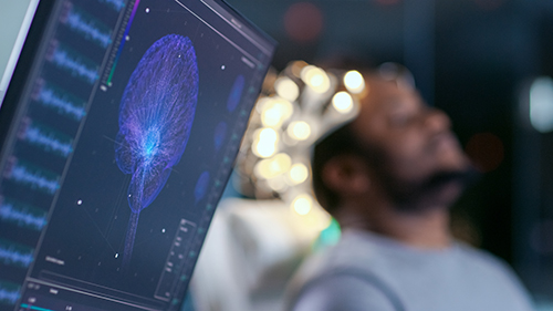 Scan of brain with patient on bed