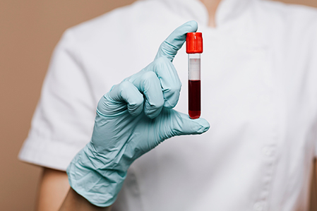 nurse holding a blood test tube