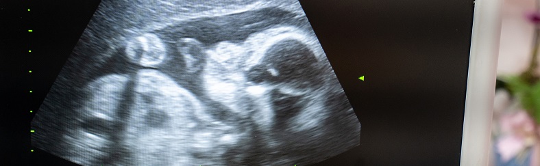 The Impact of COVID-19 on Pregnancy and Childbirth The Impact of COVID-19 on Pregnancy and Childbirth