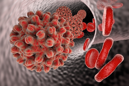 Hep B and ReFlections Hep B and ReFlections