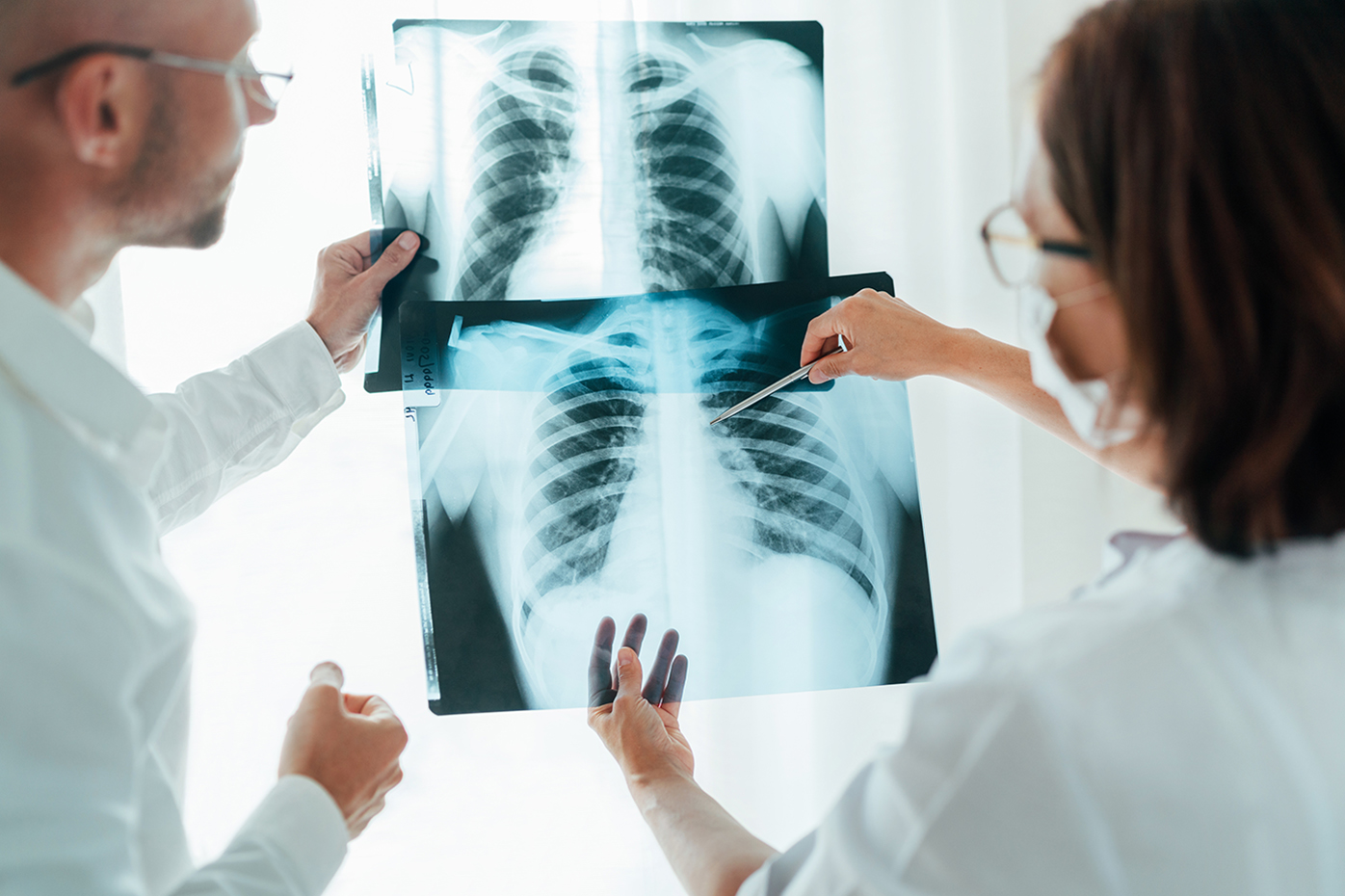 Radiology and lung analysis and lung cancerjpg