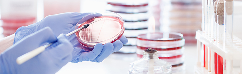 antimicrobial resistance_long antimicrobial resistance_long