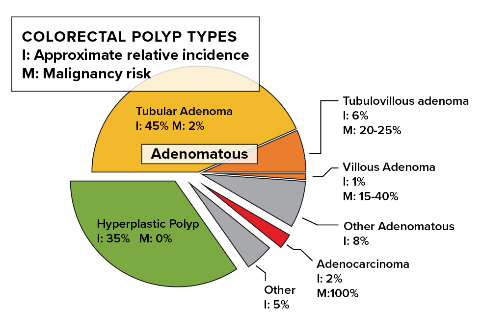 Colorectal polyp types Colorectal polyp types