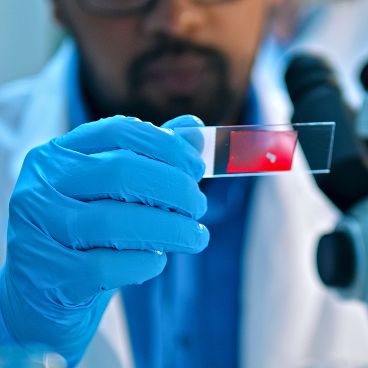 Researcher looking at a slide smear