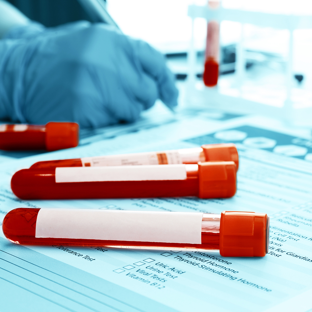 vials of red fluid on a medical order form